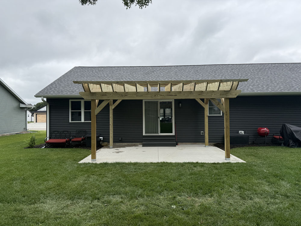 Pergola Installation
